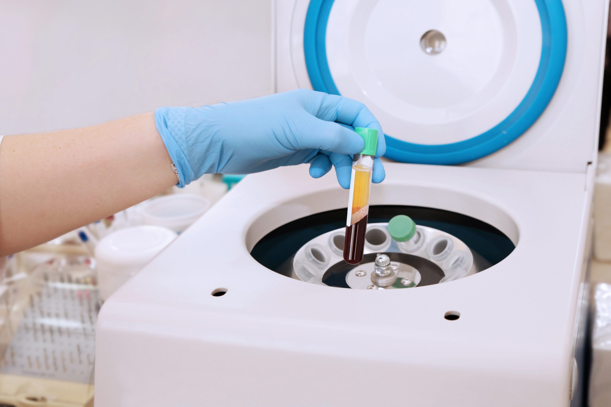 Regenerative Medicine